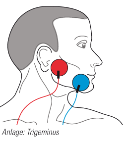 trigeminus.gif trigeminus.gif