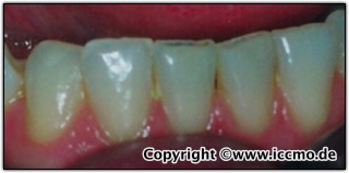 2_verschleiss_uk-front.jpg 2_verschleiss_uk-front.jpg