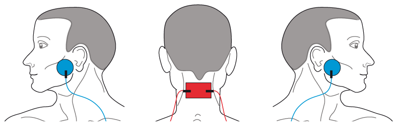 kaumuskulatur.gif kaumuskulatur.gif